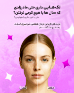 ست کرم ضد لک و تیرگی صورت و بدن | کک و مک، ملاسما، لک های بارداری، آفتاب سوختگی و جوش - Image 4