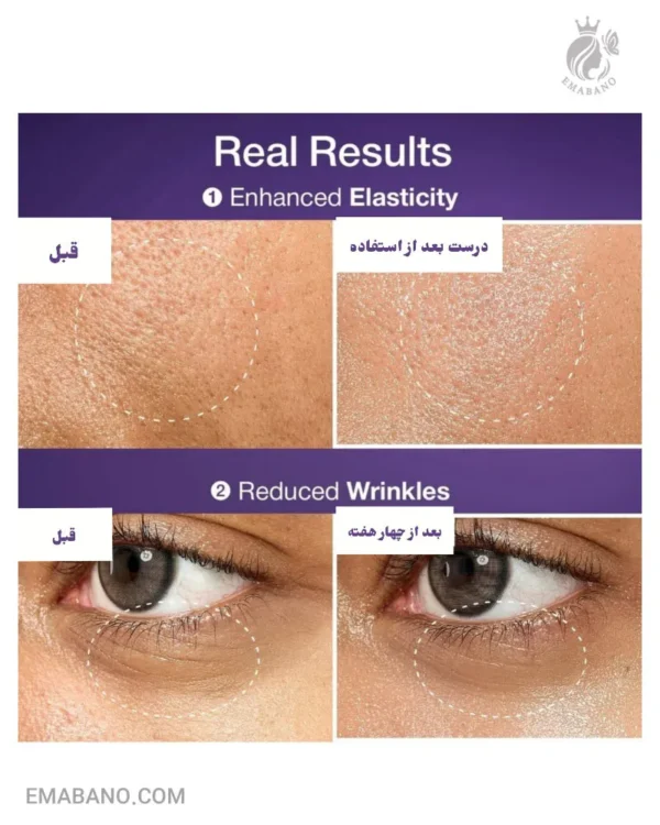 سرم اسنس لیفتینگ نامبوزین ضد چروک و سفت کننده - Image 2