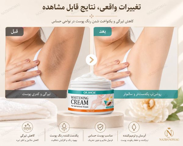 کرم سفیدکننده زیر بغل و بیکینی OUHOE - Image 3