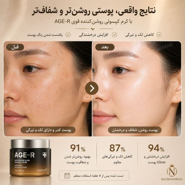 کرم کپسولی جوانساز و ضدلک گلوتاتیون مدیکیوب AGE-R | روشن‌کننده قوی - Image 5
