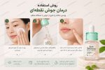 سرم ضدجوش فوری اکسیس وای - Image 3