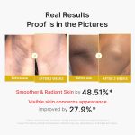 لوسیون لایهبردار بدن کوجیک اسید مدیکیوب | روشنکننده و یکدستکننده پوست بدن - Image 3
