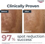 سرم دوگانه ضدلک اوسرین Anti-Pigment | روشنکننده تخصصی حاوی تیامیدول - Image 3